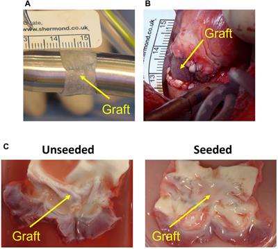 Growth capacity of a Wharton’s Jelly derived mesenchymal stromal cells tissue engineered vascular graft used for main pulmonary artery reconstruction in piglets